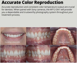 GODOX MF12-DK1 Dental Flash Kit for Sony 2-Light TTL Macro System with X2T-S Trigger and Accessories